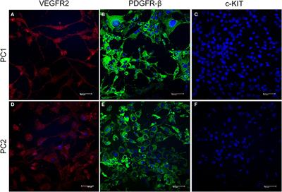 Transcriptome of Two Canine Prostate Cancer Cells Treated With Toceranib Phosphate Reveals Distinct Antitumor Profiles Associated With the PDGFR Pathway